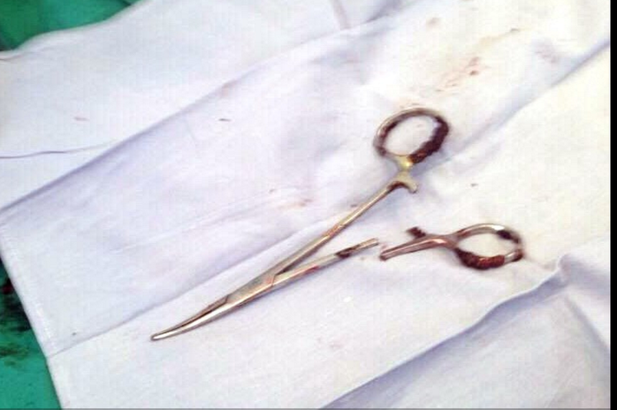 
Chiếc kéo phẫu thuật bị bỏ quên trong bụng bệnh nhân suốt 18 năm sau khi được lấy ra - Ảnh: TTX
