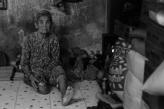 Trong khi đó Bà Lê Thị Hương (82 tuổi) phải dùng bao ni lông quấn phần chân bị cụt vì sợ mưa ướt khi ra đường