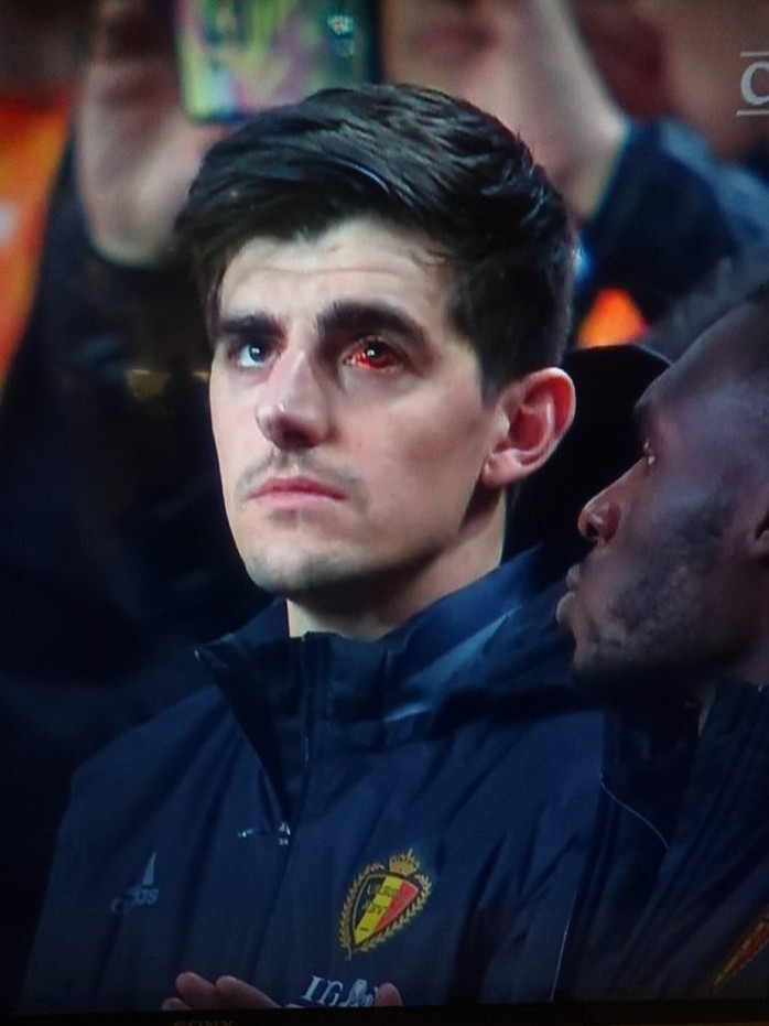 Thủ môn Courtois với mắt trái đỏ ngầu