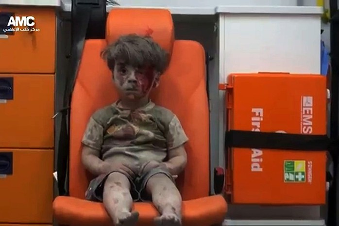 Bé Omran Daqneesh, 5 tuổi, được giải cứu trong một cuộc không kích hôm 17-8 ở TP Aleppo - Syria. Ảnh: Aleppo Media Center