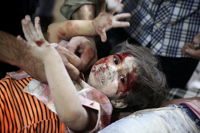 
Một bé gái trong bệnh viện dã chiến sau các cuộc không kích tại TP Douma - Syria hôm 12-9 Ảnh: REUTERS
