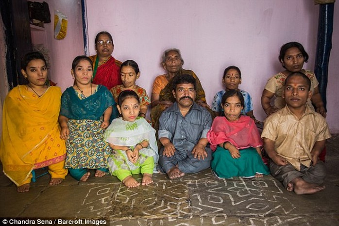 
Gia đình Chauhan có đến 9 trên 11 người là người lùn.
