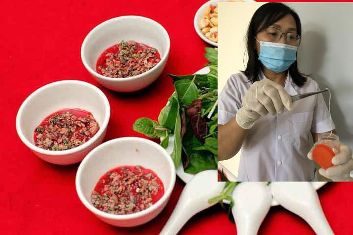 Thích ăn tiết canh, 1 nam giới lôi được giun dài từ đùi - Ảnh 2.