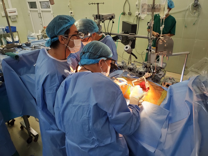 Bệnh viện Chợ Rẫy triển khai kỹ thuật mổ tim mới lần đầu tại phía Nam - Ảnh 1.