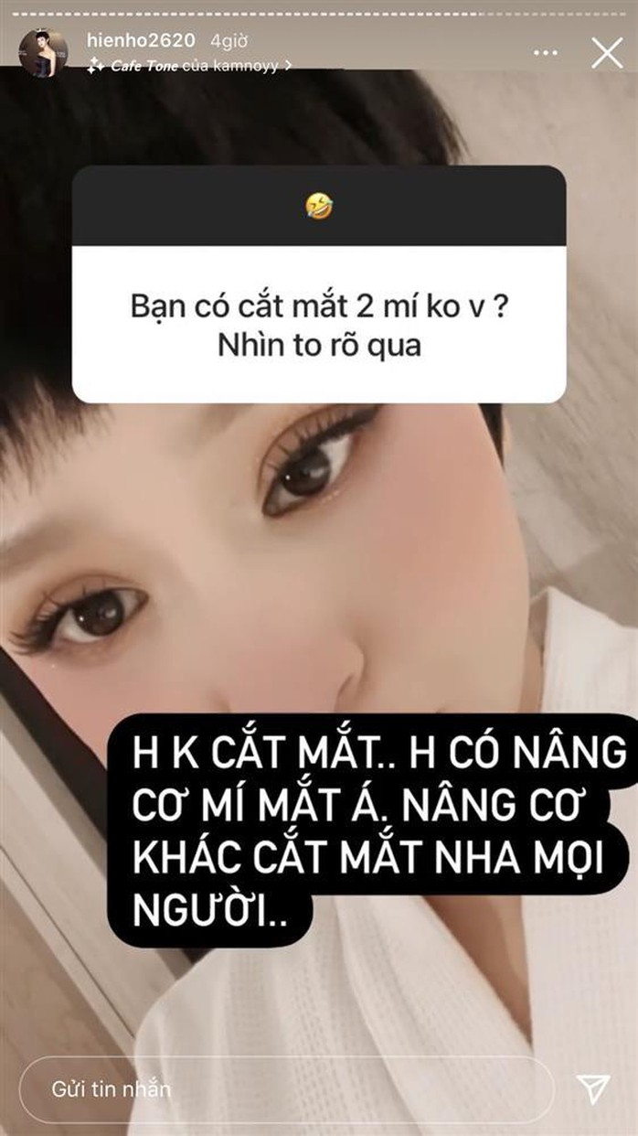 Hiền Hồ thừa nhận nắn mặt - Ảnh 3.