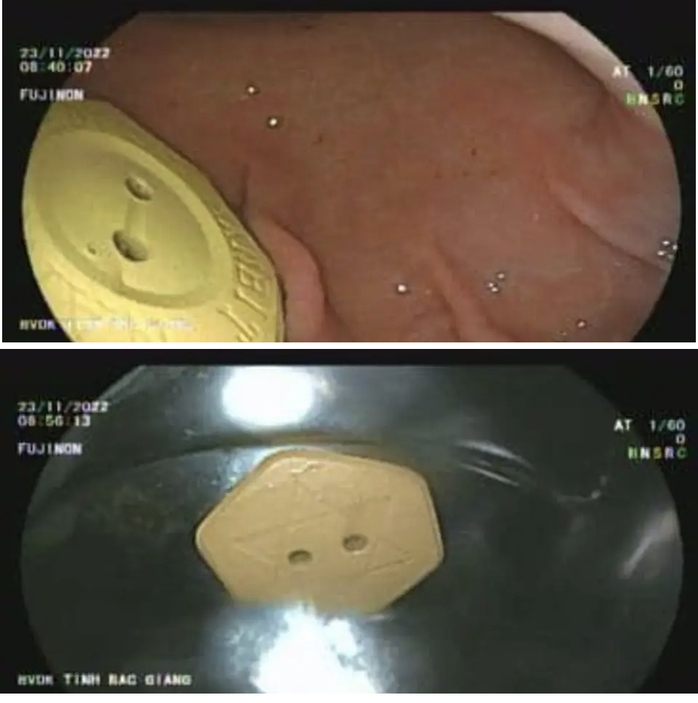 Ngủ quên, nuốt luôn viên đá quảng cáo chữa bách bệnh - Ảnh 1.