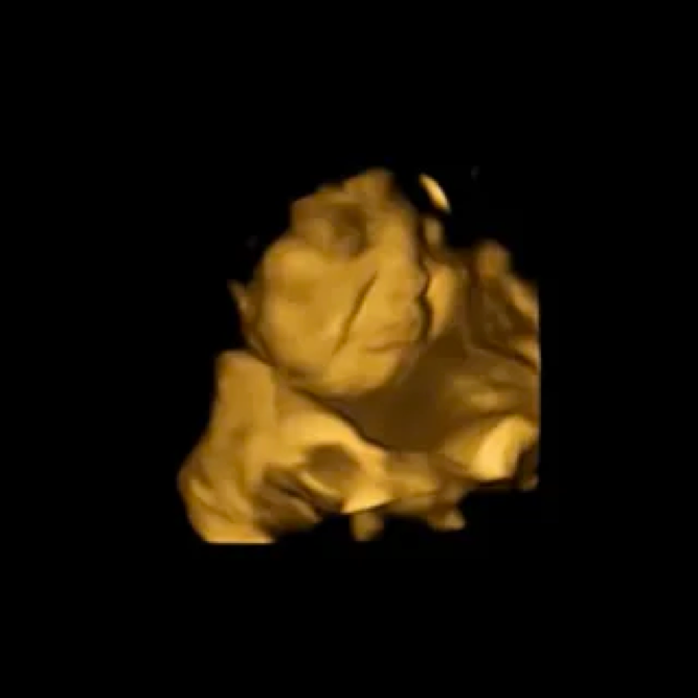 Bất ngờ về “vẻ mặt” của thai nhi trong bụng mẹ - Ảnh 2.