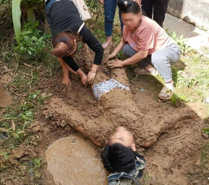 Em lao vào cứu anh trai bị điện giật, cả 2 bị thương nặng- Ảnh 1. Em lao vào cứu anh trai bị điện giật, cả 2 bị thương nặng- Ảnh 1.