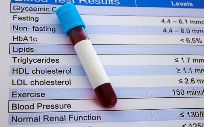 Chỉ số HDL-cholesterol được thể hiện qua kết quả xét nghiệm máu thông thường Ảnh: HARVARD HEALTH Chỉ số HDL-cholesterol được thể hiện qua kết quả xét nghiệm máu thông thường Ảnh: HARVARD HEALTH