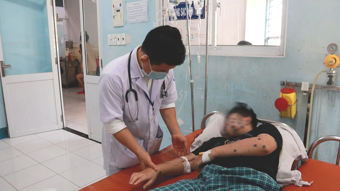 Bệnh thủy đậu vào mùa, những điều bậc cha mẹ cần lưu ý- Ảnh 1. Bệnh thủy đậu vào mùa, những điều bậc cha mẹ cần lưu ý- Ảnh 1.