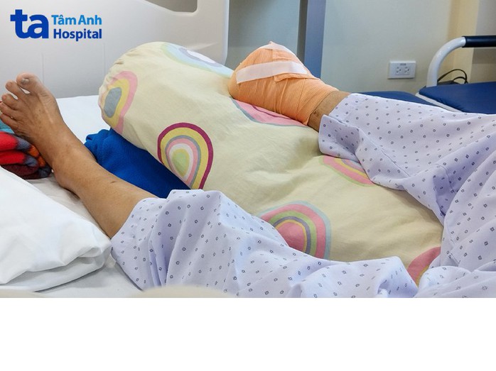 Người phụ nữ mất chân vì tự chích kim nặn mủ- Ảnh 1. Người phụ nữ mất chân vì tự chích kim nặn mủ- Ảnh 1.