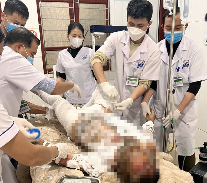 Nghi mâu thuẫn với vợ, chồng đổ xăng lên người tự thiêu- Ảnh 1. Nghi mâu thuẫn với vợ, chồng đổ xăng lên người tự thiêu- Ảnh 1.