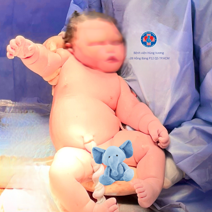 Bé trai chào đời nặng gần 5,8kg, tương đương trẻ 2 tháng tuổi - Ảnh 2.