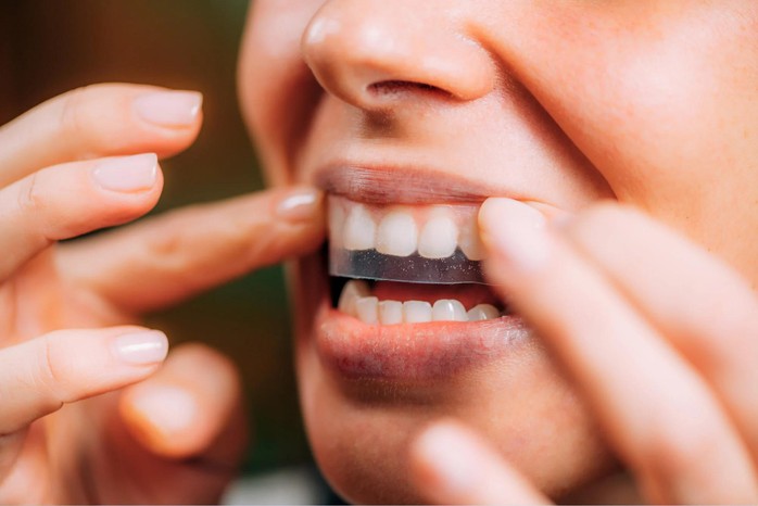 5 kiểu làm trắng răng tại nhà phổ biến: Chuyên gia tiết lộ sự thật - Ảnh 2.