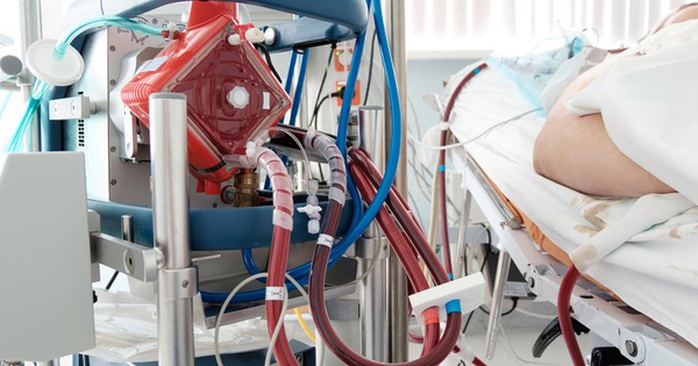 Chạy ECMO ngoài cơ thể cứu bệnh nhân nguy kịch - Ảnh 1.