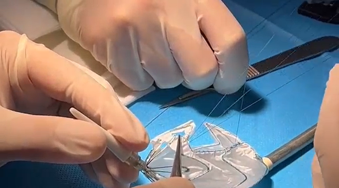 Vinmec áp dụng công nghệ 3D hỗ trợ can thiệp tim mạch lần đầu tiên ở Đông Nam Á - Ảnh 1. Vinmec áp dụng công nghệ 3D hỗ trợ can thiệp tim mạch lần đầu tiên ở Đông Nam Á - Ảnh 1.