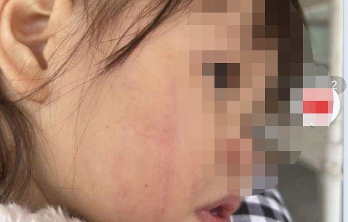 Cô giáo vung tay đánh liên tiếp vào mặt bé gái 2 tuổi - Ảnh 1.