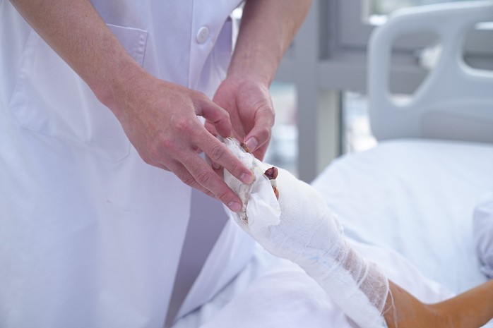 Chế pháo đón năm mới, bé 12 tuổi nát tay- Ảnh 1. Chế pháo đón năm mới, bé 12 tuổi nát tay- Ảnh 1.