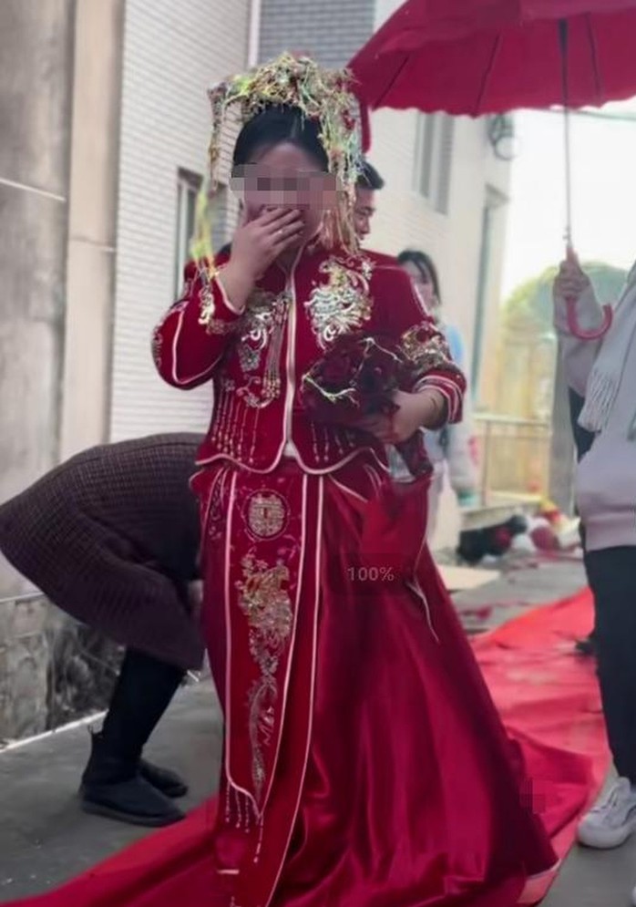 Cô dâu Trung Quốc bỏng kín mặt vì trò vui trong đám cưới- Ảnh 2. Cô dâu Trung Quốc bỏng kín mặt vì trò vui trong đám cưới- Ảnh 2.
