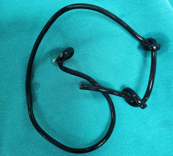 Lý do nam sinh lớp 12 nhét đoạn dây điện 26 cm vào "cậu nhỏ"- Ảnh 1.