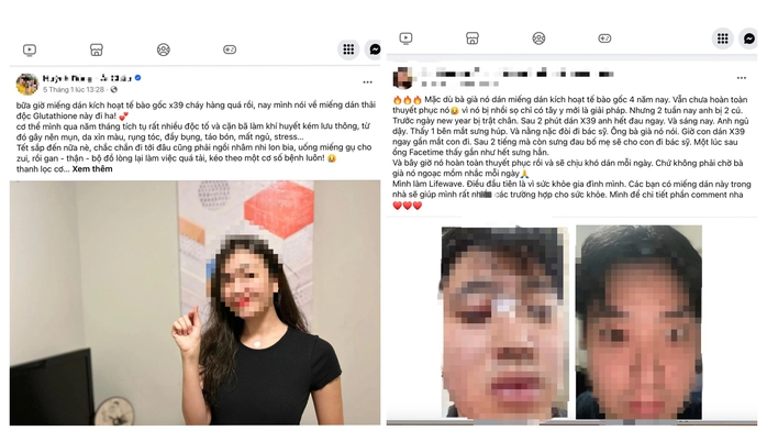 Miếng dán kích hoạt tế bào gốc có "thần kỳ" như quảng cáo?- Ảnh 1. Miếng dán kích hoạt tế bào gốc có "thần kỳ" như quảng cáo?- Ảnh 1.