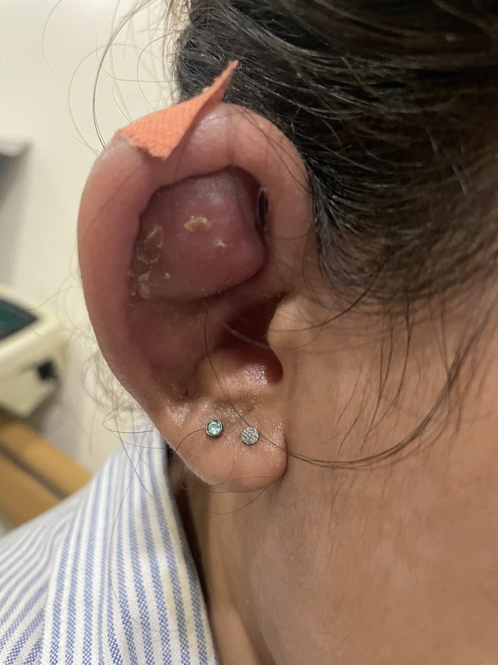 Thiếu nữ tai biến thành "Trư Bát Giới" sau làm đẹp- Ảnh 1. Thiếu nữ tai biến thành "Trư Bát Giới" sau làm đẹp- Ảnh 1.