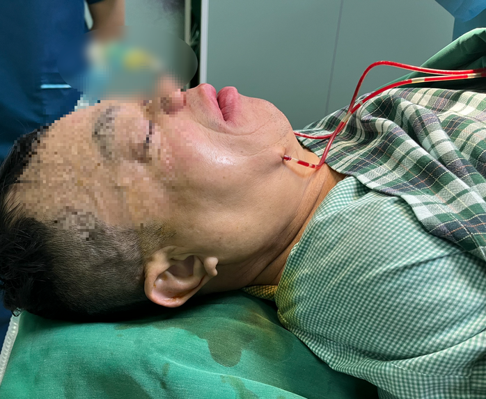 Cân não cắt hàm cứu người đàn ông "mặt ếch" 50 năm nói ngọng- Ảnh 3. Cân não cắt hàm cứu người đàn ông "mặt ếch" 50 năm nói ngọng- Ảnh 3.