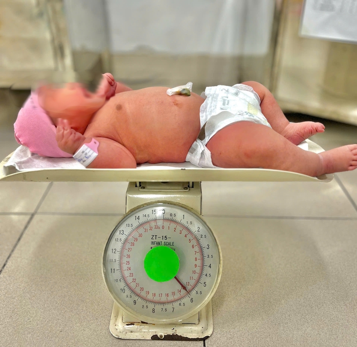 Chờ ngày đẹp để sinh mổ, thai phụ bất ngờ khi con nặng gần 6 kg- Ảnh 2. Chờ ngày đẹp để sinh mổ, thai phụ bất ngờ khi con nặng gần 6 kg- Ảnh 2.