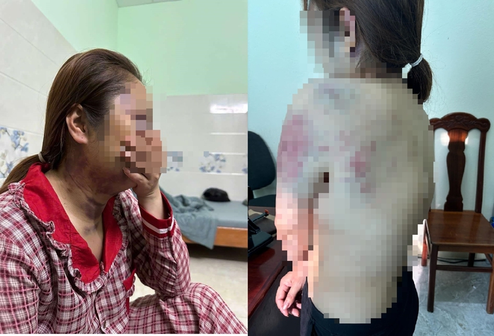 Điều tra việc người phụ nữ bị "chồng hờ" nhốt, bạo hành liên tục 13 giờ- Ảnh 1. Điều tra việc người phụ nữ bị "chồng hờ" nhốt, bạo hành liên tục 13 giờ- Ảnh 1.