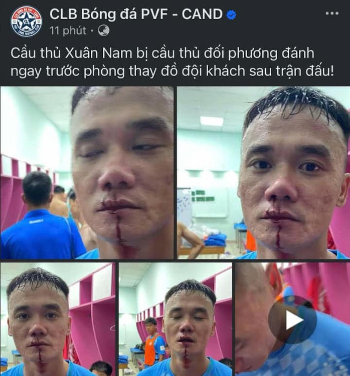 Vì sao Xuân Nam và Văn Sơn xô xát sau trận đấu?- Ảnh 1. Vì sao Xuân Nam và Văn Sơn xô xát sau trận đấu?- Ảnh 1.