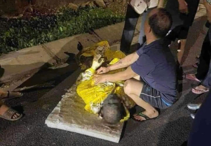 Nổ lớn trong đêm, người đàn ông bị thương nặng, da cháy đen- Ảnh 1. Nổ lớn trong đêm, người đàn ông bị thương nặng, da cháy đen- Ảnh 1.