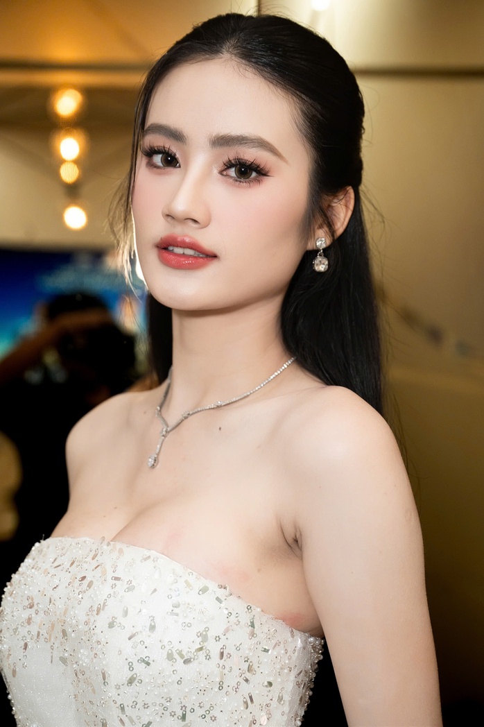 Hoa hậu Ý Nhi công khai chuyện giải phẫu thẩm mỹ- Ảnh 3. Hoa hậu Ý Nhi công khai chuyện giải phẫu thẩm mỹ- Ảnh 3.