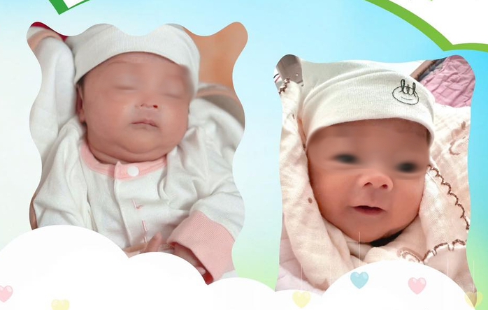 Hiếm gặp: Cặp song sinh chào đời cách nhau 5 tuần- Ảnh 1. Hiếm gặp: Cặp song sinh chào đời cách nhau 5 tuần- Ảnh 1.
