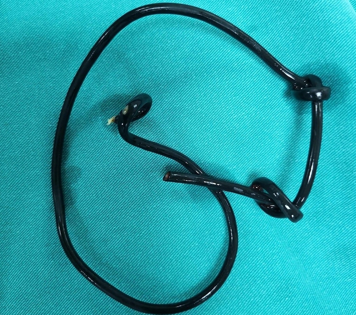 Nam thanh niên bị mắc kẹt đồ chơi tình dục dài 23 cm- Ảnh 2. Nam thanh niên bị mắc kẹt đồ chơi tình dục dài 23 cm- Ảnh 2.