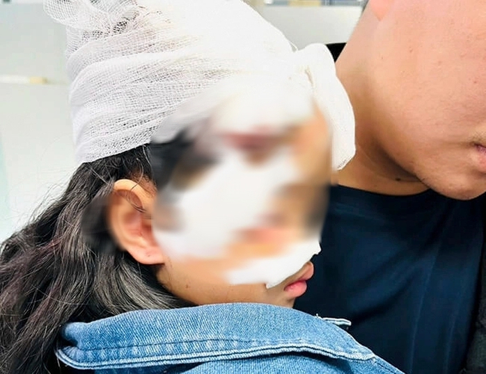 Nhiều trẻ bị chó cắn rất thương tâm- Ảnh 2.
