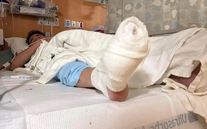Đàm Vĩnh Hưng bị tai nạn ở Mỹ- Ảnh 1. Đàm Vĩnh Hưng bị tai nạn ở Mỹ- Ảnh 1.