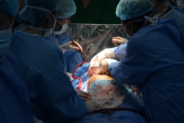 Viết tiếp kỳ tích y học Việt: Ca ghép phổi đi vào lịch sử- Ảnh 1. Viết tiếp kỳ tích y học Việt: Ca ghép phổi đi vào lịch sử- Ảnh 1.