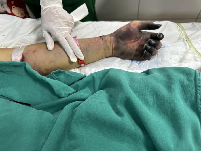 Nam bảo vệ nguy kịch do nhiễm vi khuẩn trong Nam bảo vệ nguy kịch do nhiễm vi khuẩn trong
