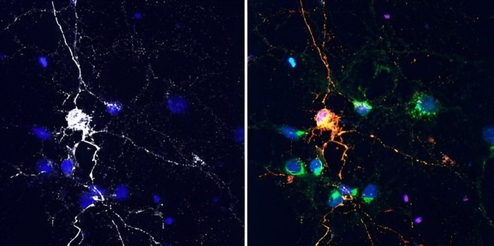 Mỹ: Nghiên cứu thuốc trị ung thư đạt được điều bất ngờ- Ảnh 1. Mỹ: Nghiên cứu thuốc trị ung thư đạt được điều bất ngờ- Ảnh 1.