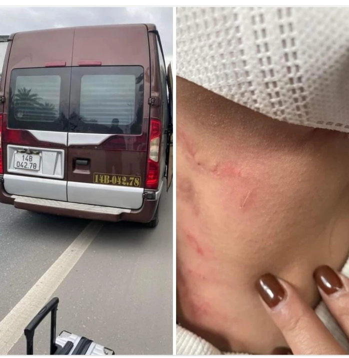 Thiếu tướng Đinh Văn Nơi chỉ đạo điều tra vụ hành khách Thiếu tướng Đinh Văn Nơi chỉ đạo điều tra vụ hành khách