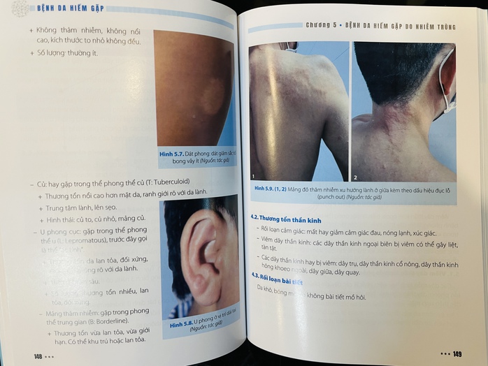 Công bố gần 50 bệnh da hiếm gặp- Ảnh 1. Công bố gần 50 bệnh da hiếm gặp- Ảnh 1.