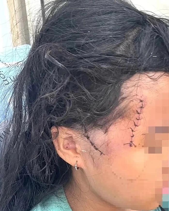 Mẹ và con gái bị người tình chém thương tích nhập viện- Ảnh 1. Mẹ và con gái bị người tình chém thương tích nhập viện- Ảnh 1.