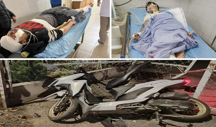 Hai nam sinh bị nhóm côn đồ tấn công nhầm- Ảnh 5. Hai nam sinh bị nhóm côn đồ tấn công nhầm- Ảnh 5.