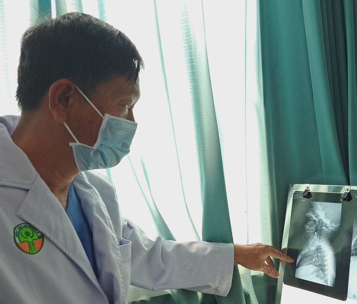 Chiếc kim băng dài hơn 3 cm trong thực quản bé trai- Ảnh 1. Chiếc kim băng dài hơn 3 cm trong thực quản bé trai- Ảnh 1.