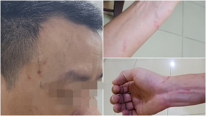 Nhóm côn đồ tấn công 2 phóng viên khi đang tác nghiệp- Ảnh 2. Nhóm côn đồ tấn công 2 phóng viên khi đang tác nghiệp- Ảnh 2.