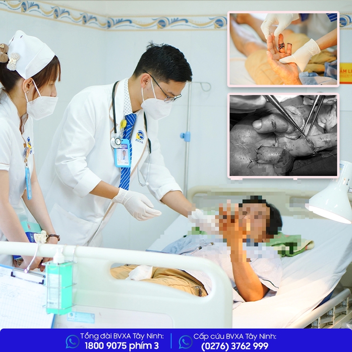 Nhiều người bị tai nạn máy cắt cụt tay, mất ngón- Ảnh 1. Nhiều người bị tai nạn máy cắt cụt tay, mất ngón- Ảnh 1.