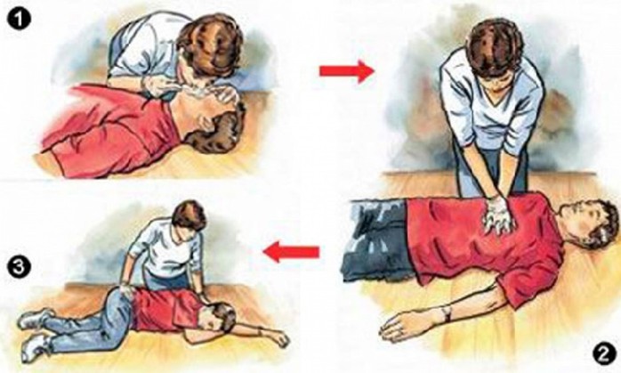 Cứu người đàn ông ngưng tim do điện giật- Ảnh 1. Cứu người đàn ông ngưng tim do điện giật- Ảnh 1.