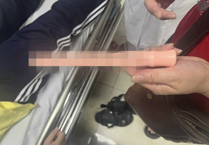 Nam sinh cấp cứu vì đồ chơi tình dục mắc kẹt trong hậu môn- Ảnh 1. Nam sinh cấp cứu vì đồ chơi tình dục mắc kẹt trong hậu môn- Ảnh 1.