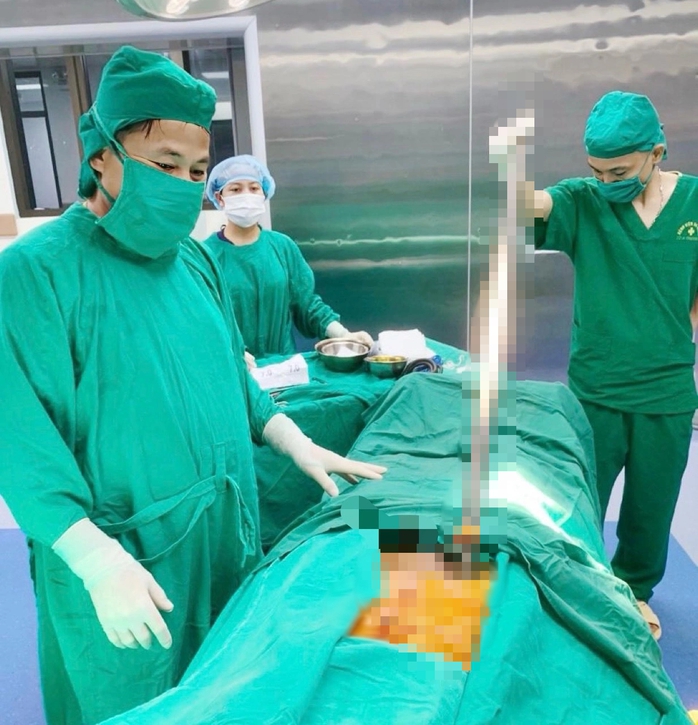 Thanh xà beng dài 1 m đâm xuyên bụng người đàn ông- Ảnh 1. Thanh xà beng dài 1 m đâm xuyên bụng người đàn ông- Ảnh 1.