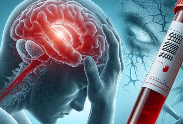 Xét nghiệm máu đột phá giúp dự đoán trước đột quỵ- Ảnh 1. Xét nghiệm máu đột phá giúp dự đoán trước đột quỵ- Ảnh 1.